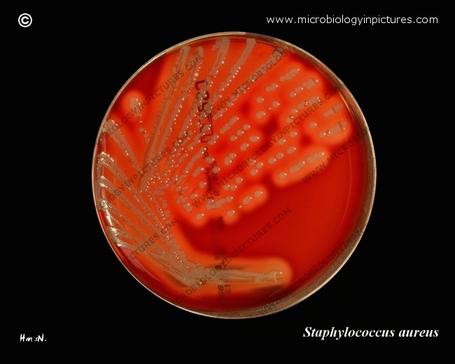 s.aureus on nutrient agar